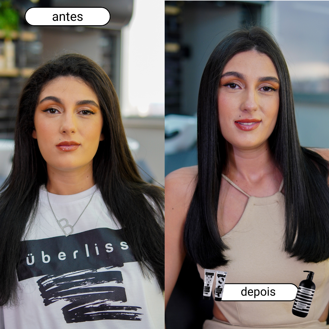 Antes e depois do tratamento Uberliss Pro