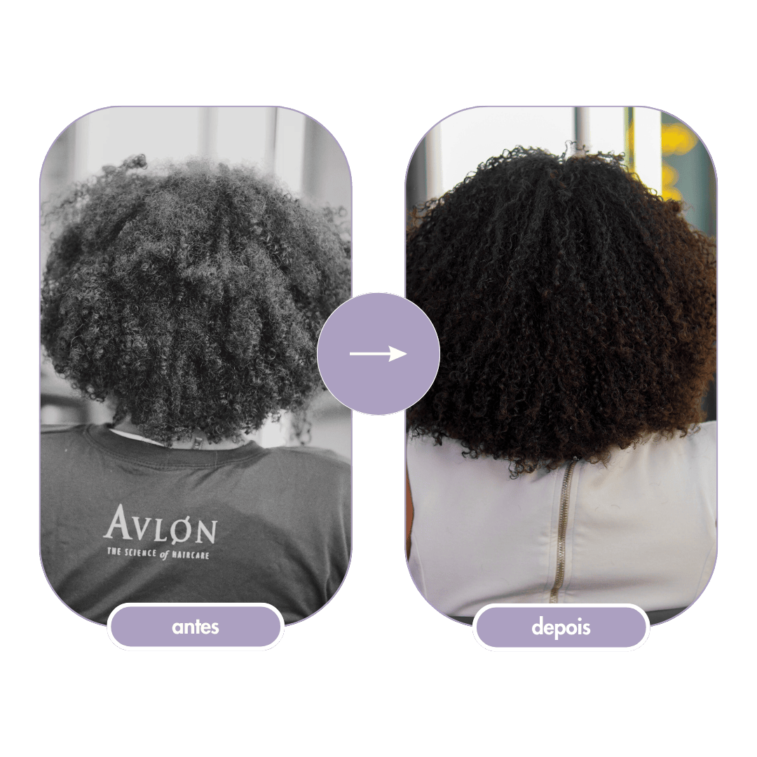 affirm avlon brasil antes e depois