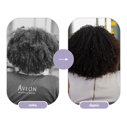 affirm avlon brasil antes e depois